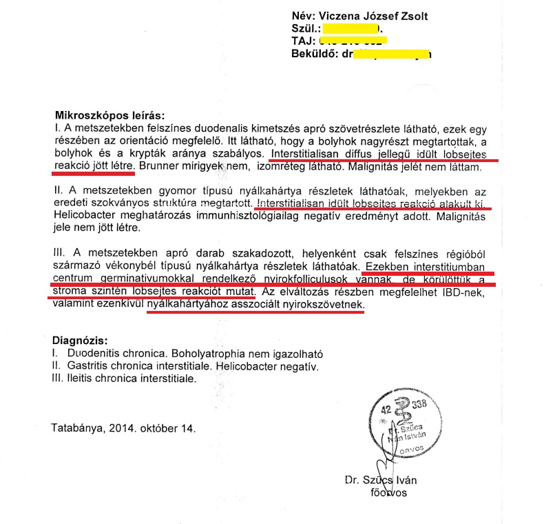 gyomortükrözés szövettani lelete, MALT, krónikus gyulladás, biopszia