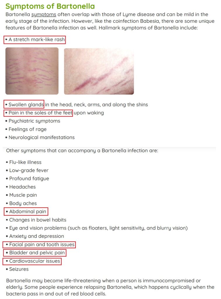 Összefoglaló lista a krónikus Bartonellózis, Bartonella Henselae fertőzés tüneteiről. Leggyakoribb Bartonella tünetek: Stria, duzzadt nyirokcsomók, talpfájdalom, dühkitörések, fejfájás, izomfájdalom, hasi fájdalom, arcfájdalom és fogászati problémák, hólyag és kismedencei tünetek, szív és érrendszeri tünetek, szemproblémák