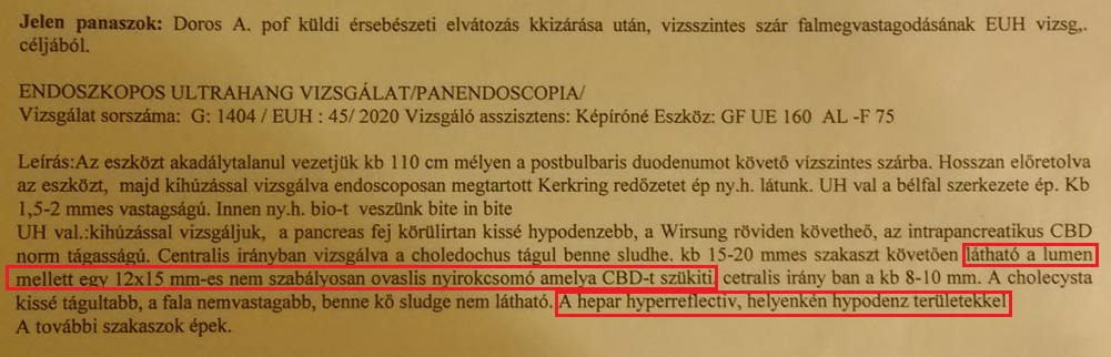 endoszkópos ultrahang, EUH vizsgálat