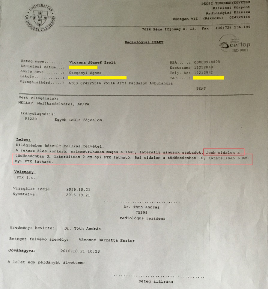 Dr Almási Róbert Gyula, Pécsi Klinika, Pécsi Fájdalomambulancia, műhiba - kétoldali légmell (ptx, pneuothorax), intenzív osztály