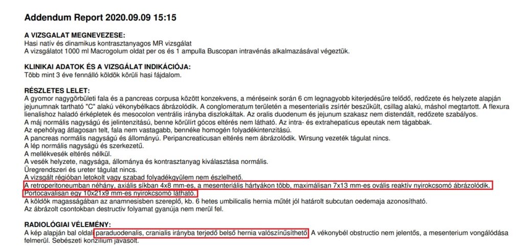 kontrasztanyagos hasi MR vizsgálat a Bank Centerben, lelet: hasi nyirokcsomók (mesenterialis és retroperitonealis nyirokcsomók), paraduodenalis belső, hasüregi sérv, Dr Tombácz Andrea - leletező orvos