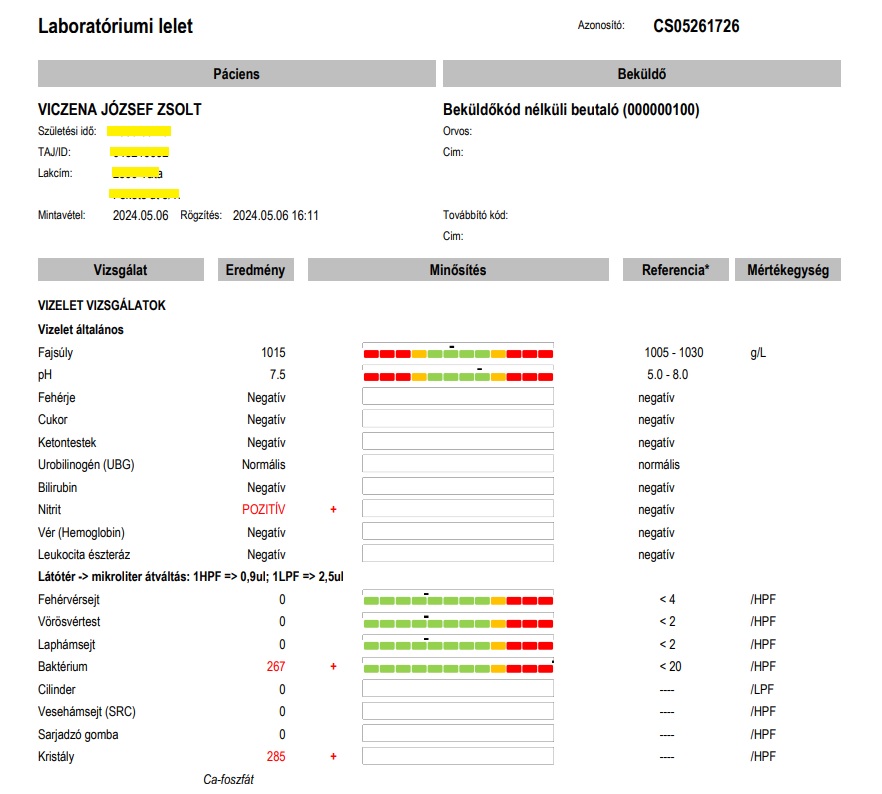 Kezeletlen, elhúzódó vesemedence-gyulladás lelete 3 hónap után: nitrit pozitív, sok baktérium a vizeletben - bakteriuria, kristályürítés - Kalcium foszfát. / Dr. Tőke Judit
