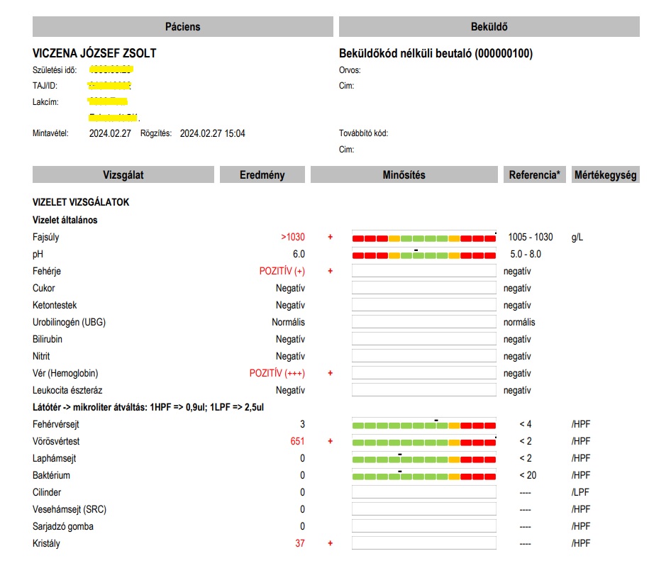 Vesemedence-gyulladás, vesefertőzés Synlab vizeletvizsgálat lelete: vérvizelés, fehérjevizelés, kristályürités (crystalluria), vvt zsúfolva/látótér.