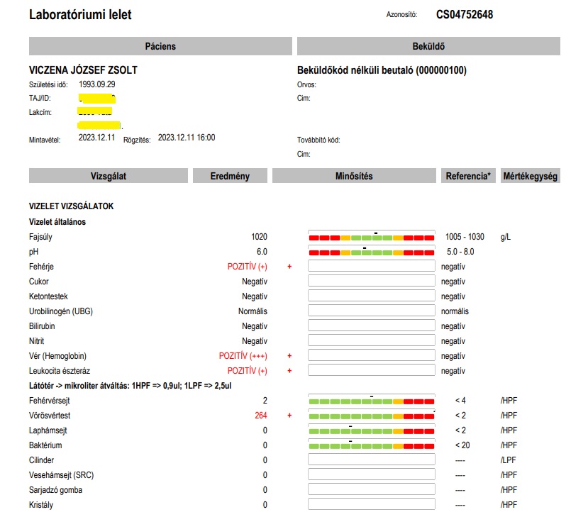 ESWL utáni fertőzés, Vesemedence-gyulladás figyelmeztető vizelet lelete: 3 keresztes vérvizelés, 2 keresztes fehérjevizelés, pozitív leukocita észteráz, több mint százszoros vörösvértest értékek.