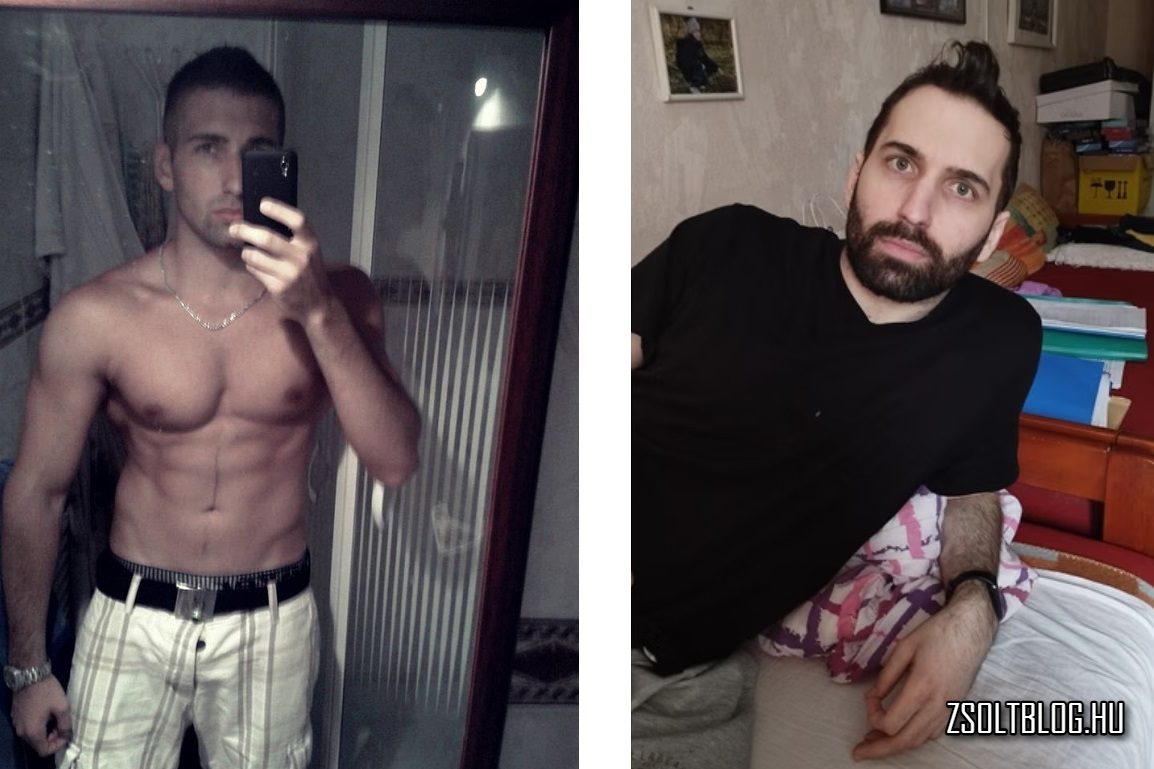 Viczena Zsolt, betegsége